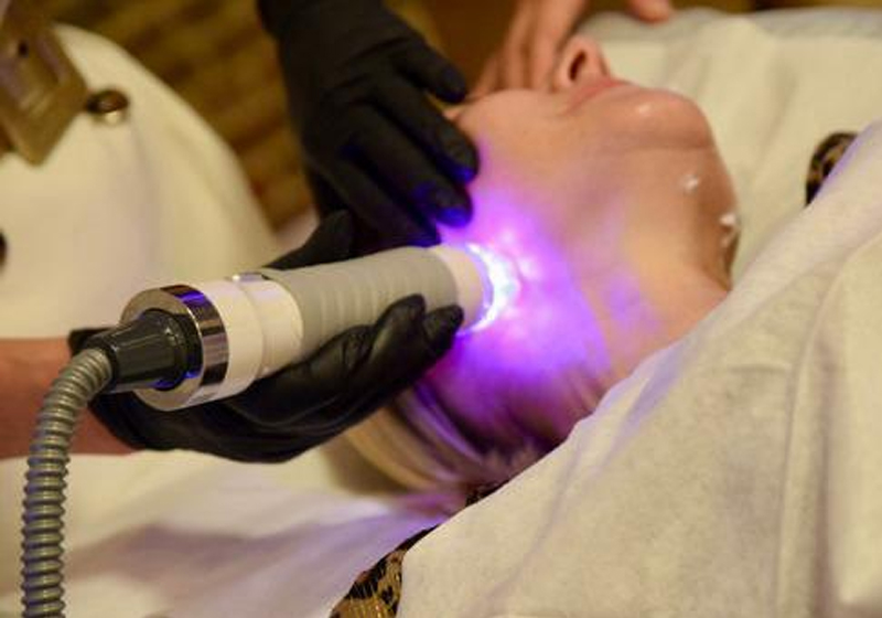 Vivace RF Microneedling with Exosomes
